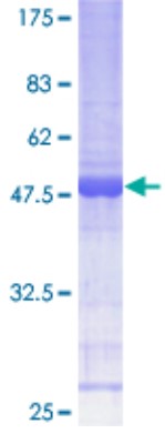 SDS-PAGE (CRIP2-1875H).jpg